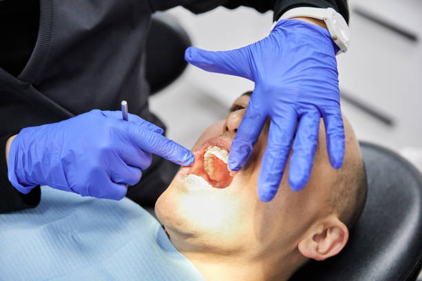 Best Weekend Emergency Dentist in Ponchatou, LA